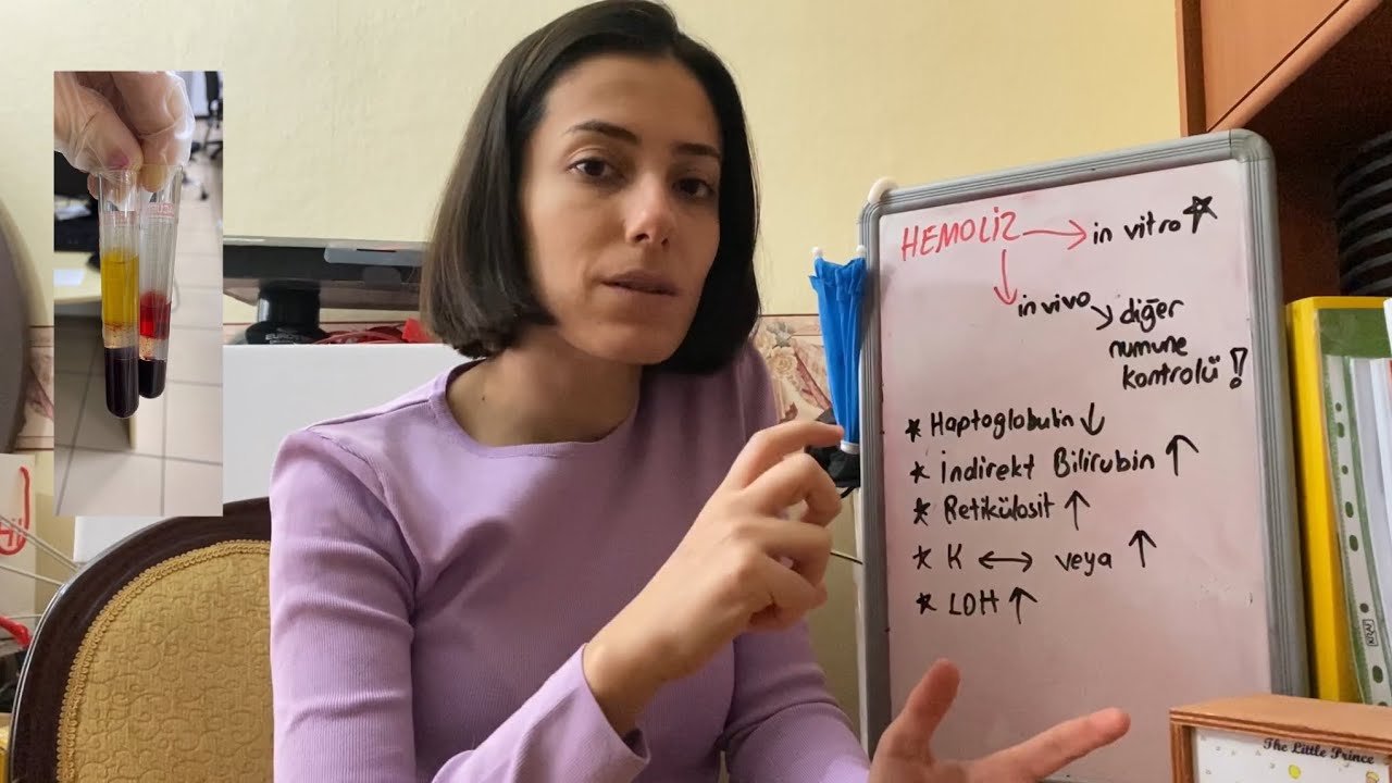 Hemoliz Nedir? Hemoliz Ne Tür İnterferanslara Sebep Olur?