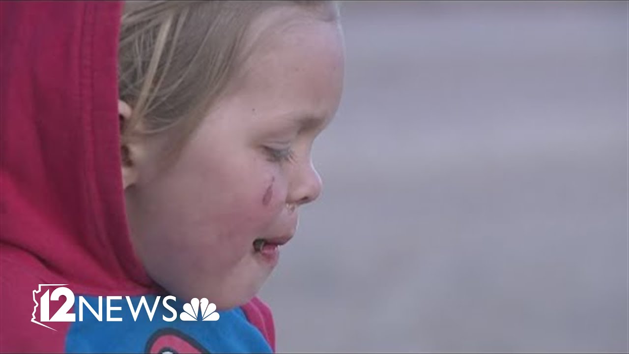 Parents of missing toddler found by dog say a 'miracle' saved their son