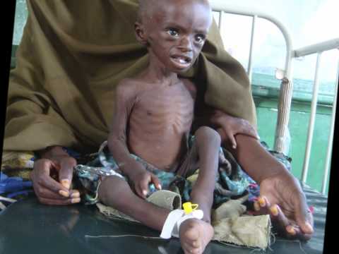 Video: Hungersnöd I Somalia: En Uppdatering På Marknivå - Matador Network