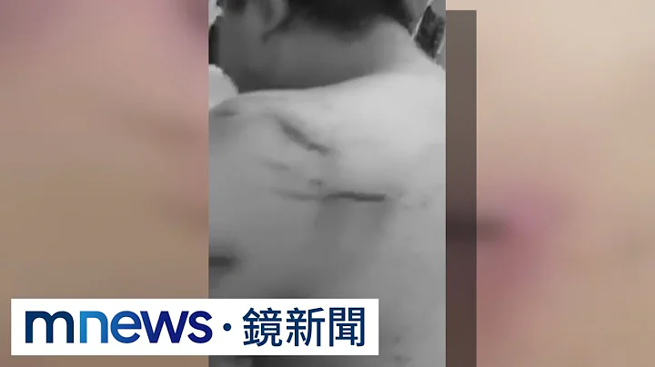 拒幫忙詐騙遭毒打！　赴柬埔寨求職者傷勢曝光｜#鏡新聞 - 天天要聞