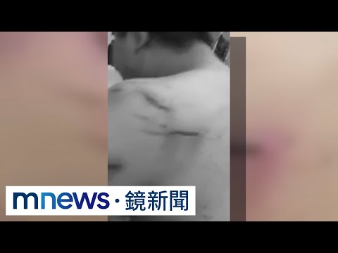拒幫忙詐騙遭毒打！　赴柬埔寨求職者傷勢曝光｜#鏡新聞