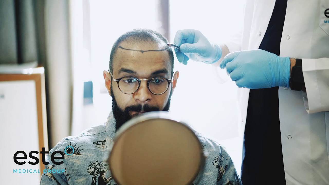 Hair Transplant Ajay Este Medical Group YouTube