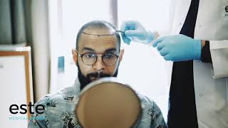 Hair Transplant Ajay Este Medical Group