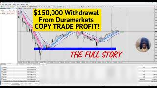 $150,000 Duramarkets Withdrawal From Copy Trade and Members Profit #FOREXLIVE #XAUUSD