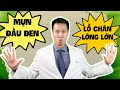 MỤN ĐẦU ĐEN và LỖ CHÂN LÔNG TO - Bạn có thể xử trí đơn giản TIẾT KIỆM ngay cả khi BẬN| Dr Hiếu