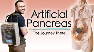 The Journey to an Artificial Pancreas