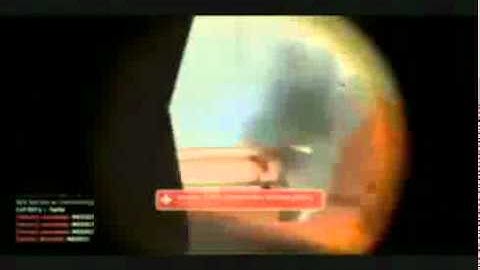 Team Fortress 2 WALLHACK | AMIBOT | CHEATS + Working Download Link