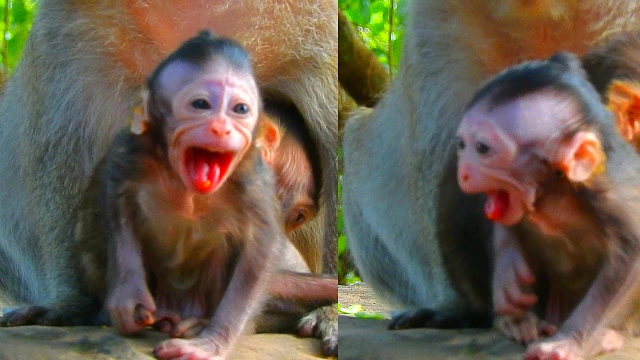 Omg! Really Something Stuck Inside Newborn's Neck! Very Big Problem...!