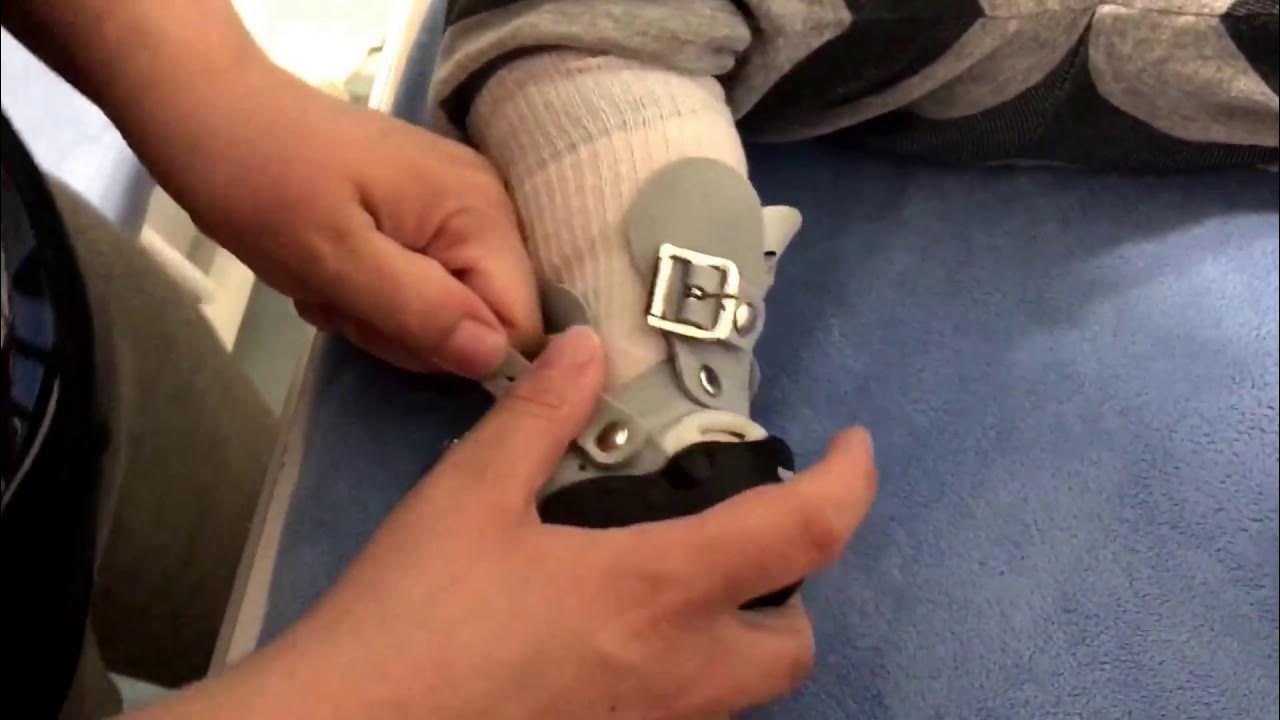 Clubfoot Ponseti Shoes/Bar tutorial YouTube