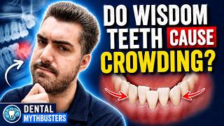 Do Wisdom Teeth Cause Crowding? | Dental Mythbusters