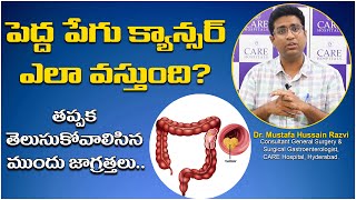 Colon Cancer causes, symptoms & Treatment in Telugu | Large Intestine |  Pedda Pegu Cancer