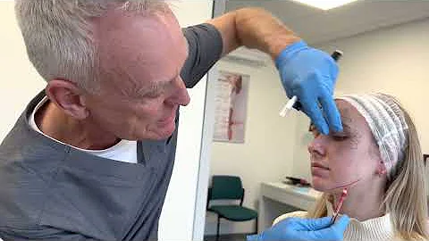 Botulinum Toxin for the Lower Face | Cosmetic Cour...