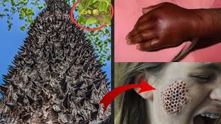 10 Most Dengerous Trees "They Can Kill You "