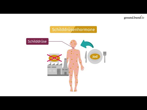 Video: Wann multinodulärer Kropf biopsiert werden?