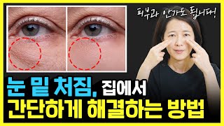 눈밑 처짐, 눈밑 지방은 돈 안 들이고 집에서 간단하게 해결하세요!ㅣ 눈밑이 불룩해지는 이유와 홈케어 방법