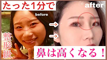 鼻の骨ない人 鼻の骨ない人