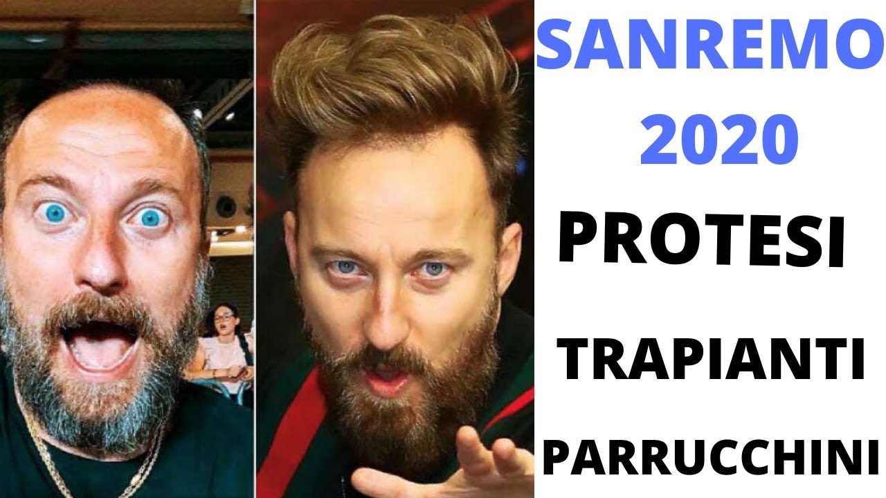 SANREMO 2020: protesi capelli, toupet, parrucchino, trapianti e Toppik! -  YouTube