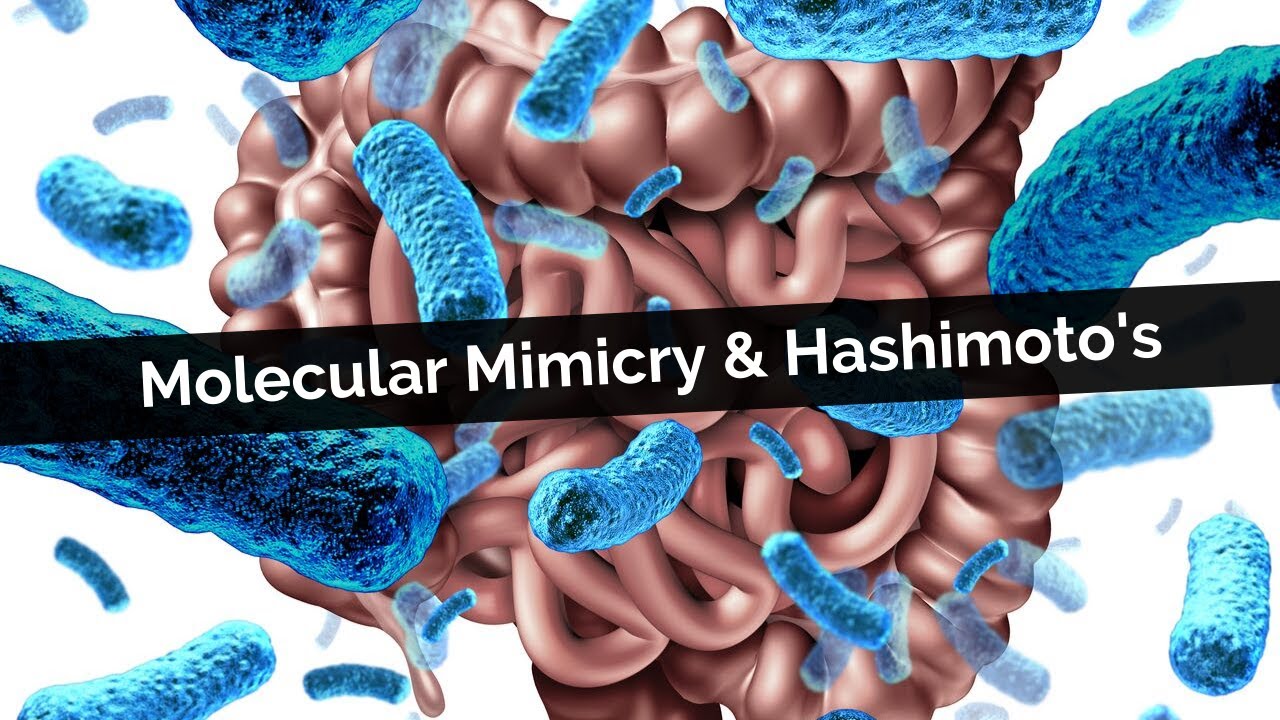 Molecular Mimicry Immune Response To A Food And Hashimoto s YouTube molecular-mimicry-immune-response-to-a-food-and-hashimoto-s-youtube