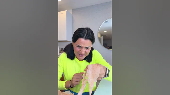 She REMOVED his HANGNAIL 😱🖐🤣 #shorts #khamitovy #martaandrustam