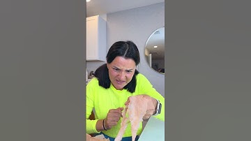 She REMOVED his HANGNAIL 😱🖐🤣 #shorts #khamitovy #martaandrustam