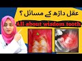 Wisdom tooth faqs  aqal darh ka nikalna urdu