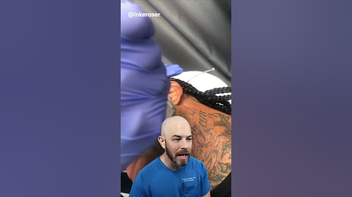 This face tattoo is getting a transformation! (credit: inkeraser on TT)  #doctor # #viral #trending