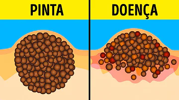 Pode espremer pinta?