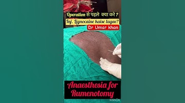 Rumenotomy l Bloat l Tympani l dr Umar khan