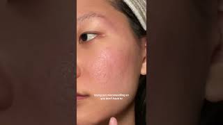 MICRONEEDLING/DERMA STAMP FIRST IMPRESSIONS (BANISH 2.0 PT 2) by matchamaddie ♡ ˚.*ೃ 671 views 3 weeks ago 1 minute, 17 seconds