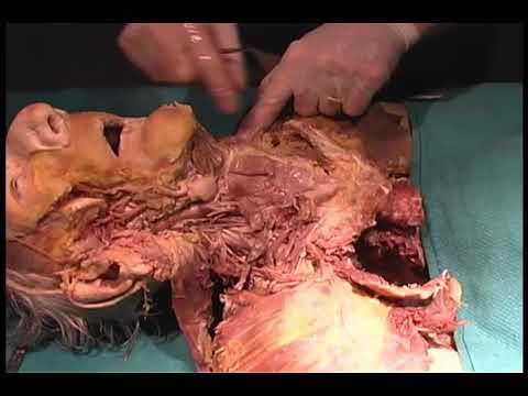 Human Body Dissection(12) - YouTube