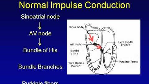 ECG interpretation-Module 1- ECG Basics.mp4