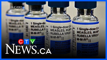 Canada losing its measles-free status a ‘wake-up call’