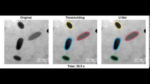 Liquid phase electron microscopy with combined machine learning in action.
