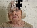 Болезнь Альцгеймера - что это такое и кто болеет