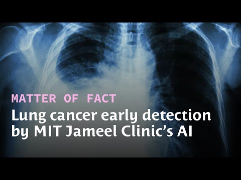 AI predicts lung cancer 6 years early | Soledad O'Brien explores the MIT Jameel Clinic's Sybil tool