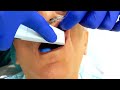Digital impression in dentistry. Digital Scanning impression.