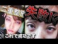 【 二重整形 】 双子モデル が 二重全切開 について 話します。【 クリニック紹介 】