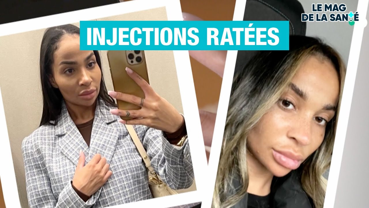 💉 MÉDECINE ESTHÉTIQUE : les dérives - Allo Docteurs
