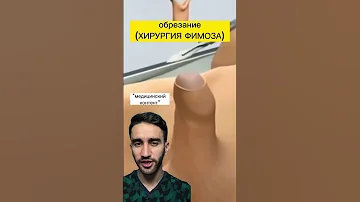 обрезание крайней плоти или циркумцизия