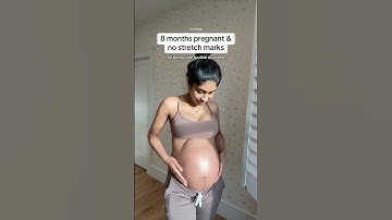 My pregnancy bump routine to help prevent stretch marks as a derm #stretchmarks