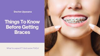 DENTAL BRACES | Things You Need To Know Before Getting Braces / Do's & Don'ts / Tips & Tricks