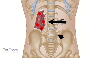 Quadratus Lumborum (QL) Trigger Points Explained | Causes, Symptoms, and Pain Relief