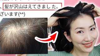 髪が増えた人続出 薄毛対策頭皮ケアマッサージ 育毛 美顔ヨガで黒髪フサフサ 歳若返ろう Youtube 髪が増えた人続出 薄毛対策頭皮ケアマッサージ 育毛 美顔ヨガで黒髪フサフサ 歳若返ろう Youtube
