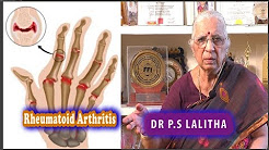 Rheumatoid Arthritis Pain Relief |Dr. P.S.Lalitha
