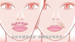 【dermes x Zarla Au】Unfine 毛-Ment 之初吻篇