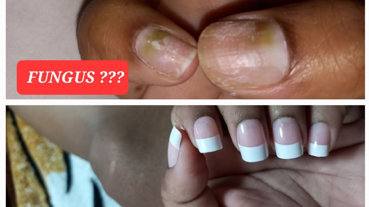Why Are My Dip Nails Turning Yellow? - Fairy Glamor