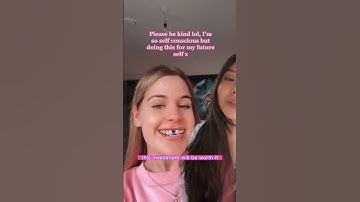 Palatable Expander. Be kind! #orthodontics #dentist #gap