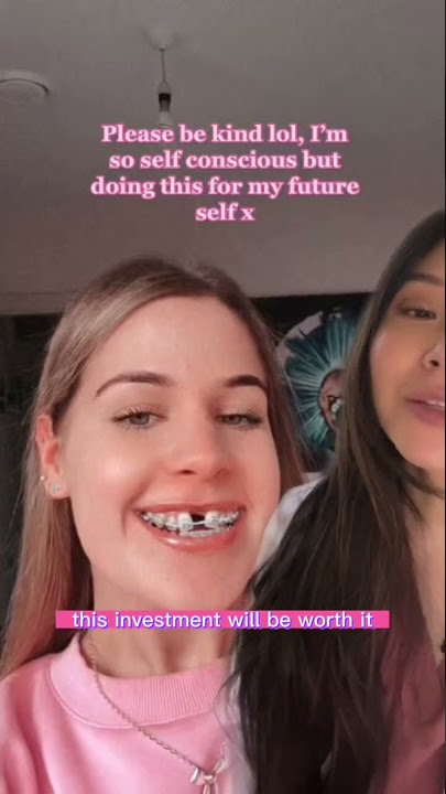 Palatable Expander. Be kind! #orthodontics #dentist #gap