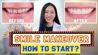 Veneers? Crowns? Smile Makeover MUSTKNOWS | #SmileMakeover !