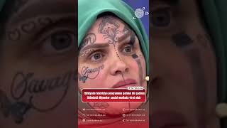 Türkiyədə Televiziya Proqr Qatılan Bir Qadının Üzündəki Döymələr Sosial Mediada Viral Olub